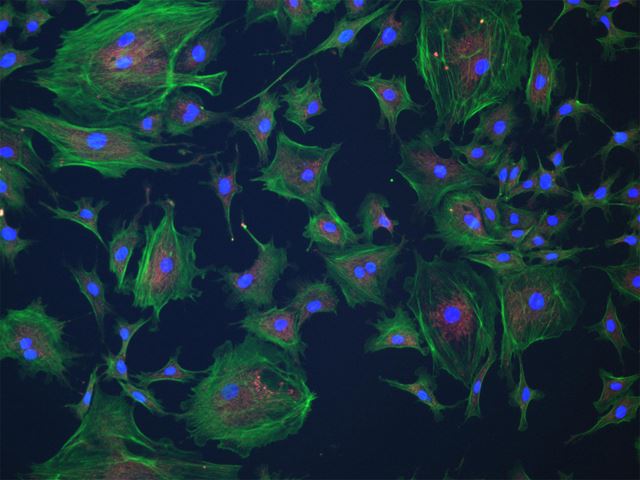 3-channel fluorescence of BPAE cells